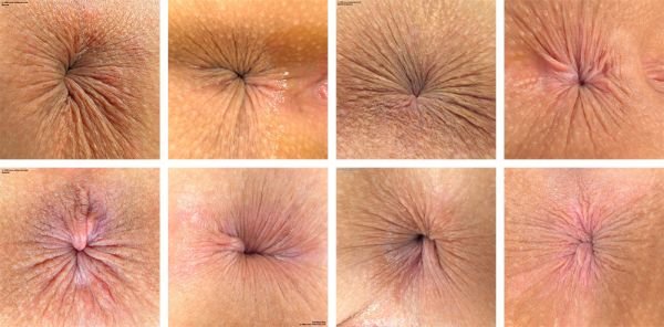 Anal Bleaching and Confidence: How It Can Boost Self-Esteem